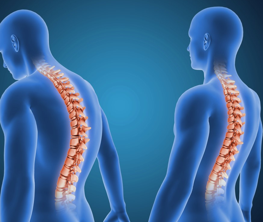 10 Simple Exercises to Improve Posture Fast