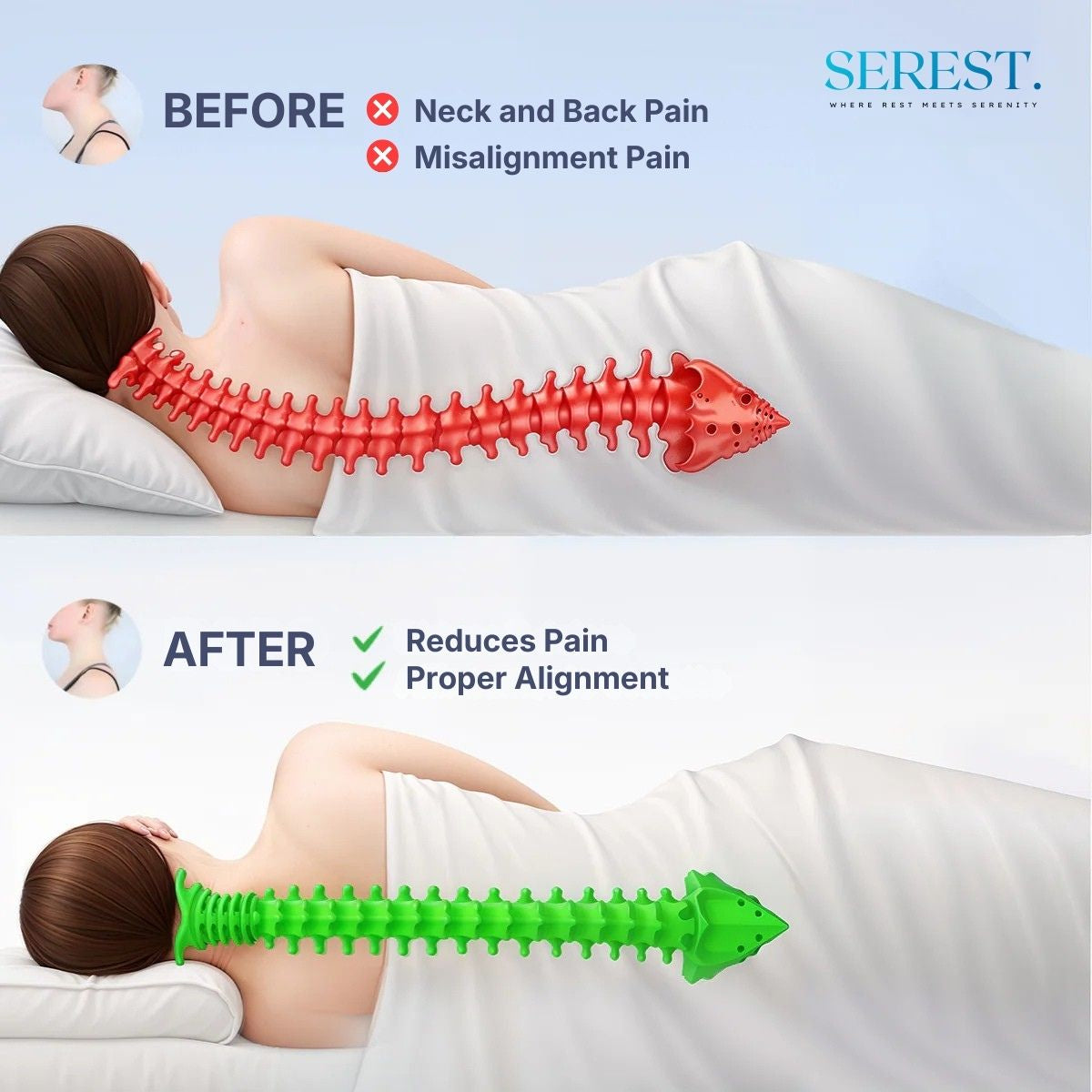 SEREST. CerviRest – Cervical Relief
