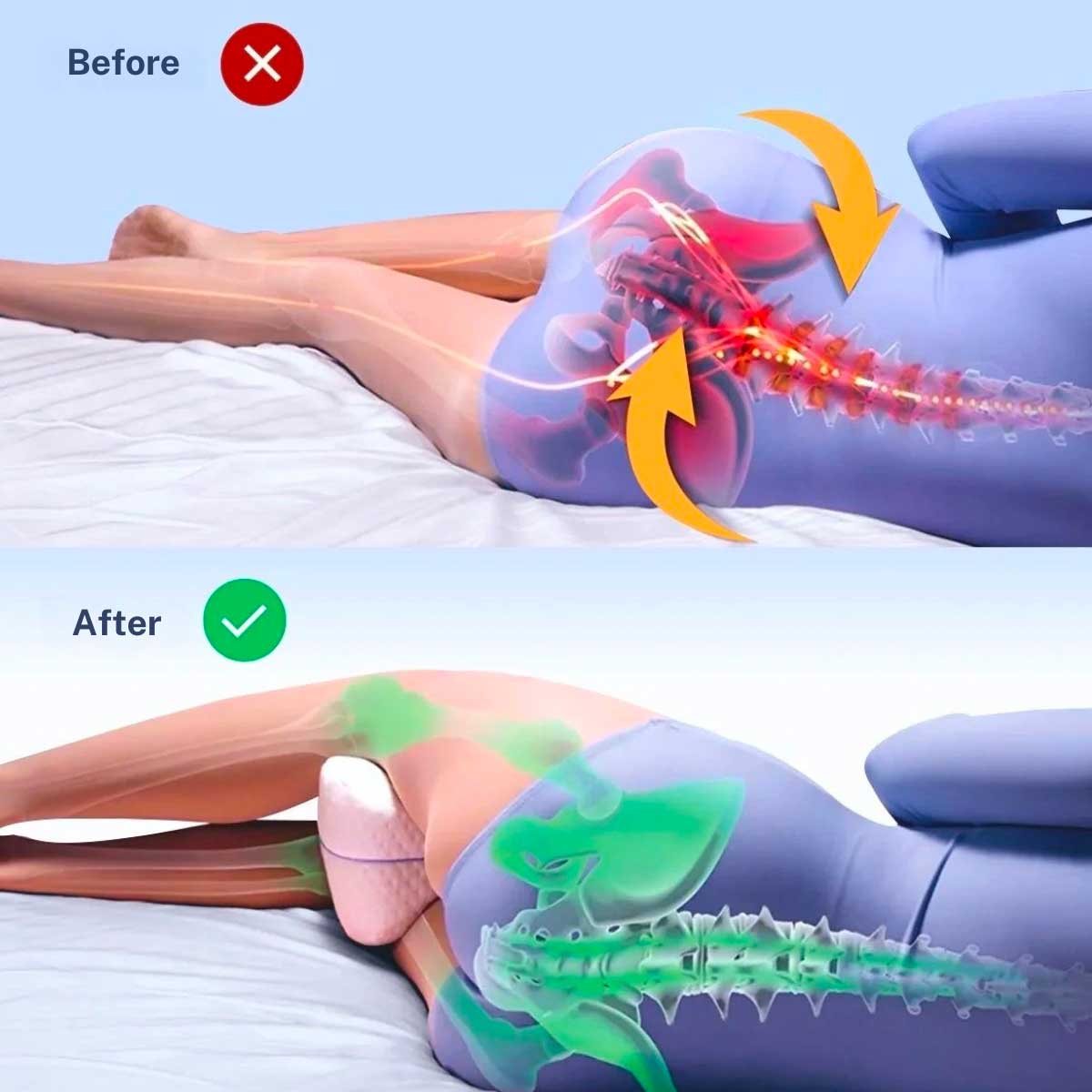 SEREST. FlexAlign – Pillow for Hips, Sciatica, and Legs